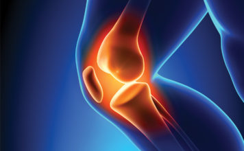 Innovador método para la revisión de reemplazo total de rodilla