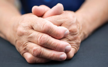 ¿Qué es la artritis reumatoide?